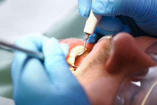 Best Emergency Denture Repair in Lincoln Village, OH